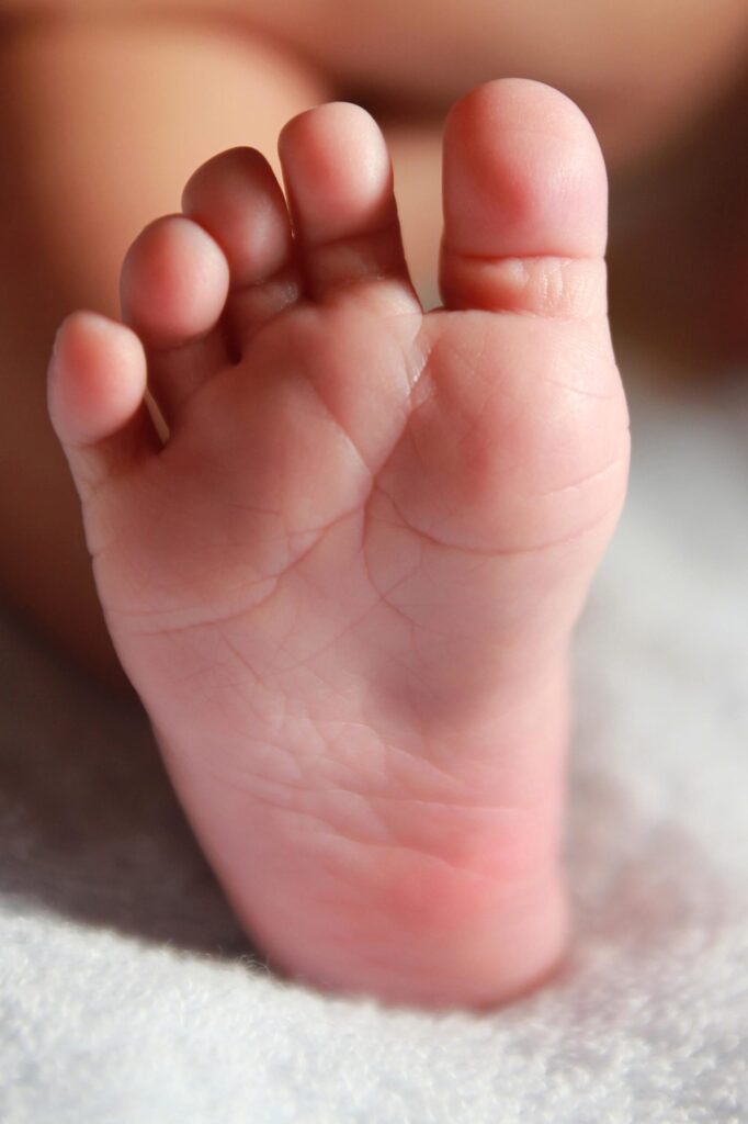 Piede infantile