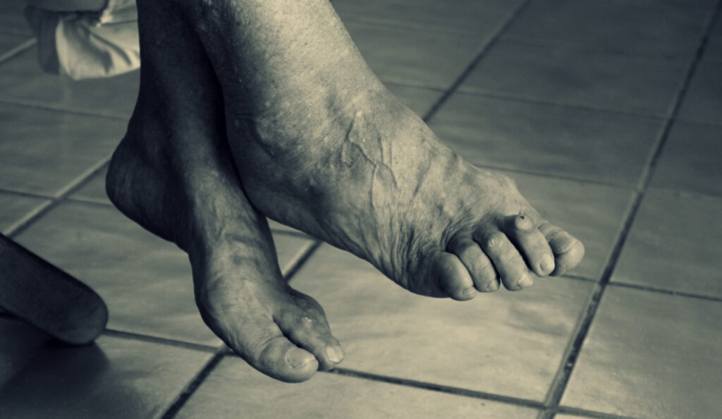 Piede geriatrico
